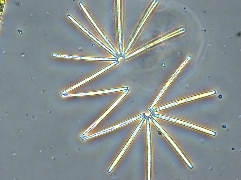 Phytoplankton in the form of a diatom chain.