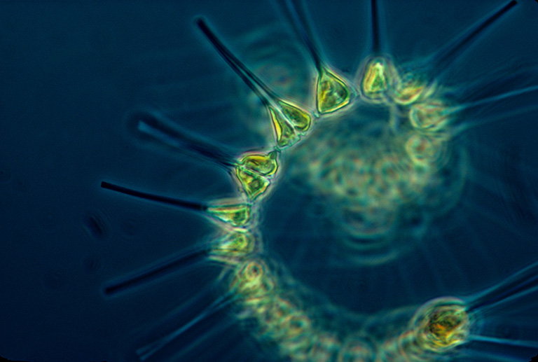 Micrograph of phytoplankton. Image by NOAA MESA Project, via the NOAA Photo Library.