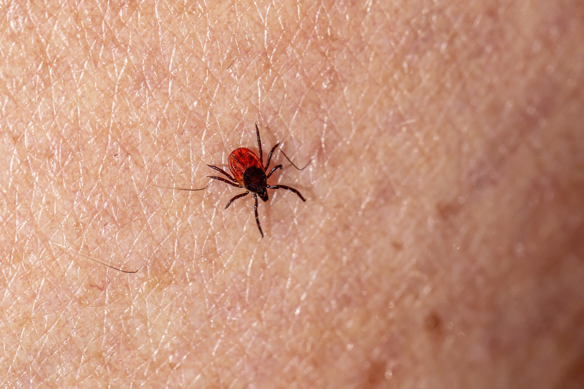 A very small tick insect about the size of a fingernail on top of human skin. The tick has eight black legs, four on each side of its body. The insect's body is oval-shaped, with half its body red and black, and the other half just black. The tick has a black, rectangular-shaped head attached to the black half of the body.