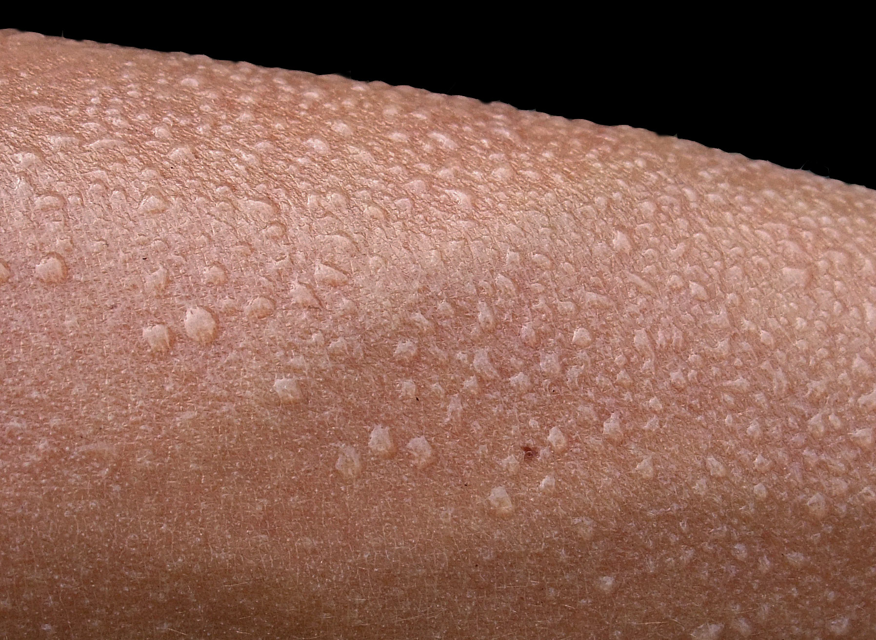 Up-close view of sweating skin